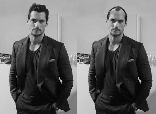 Man in dark suit with and without hair